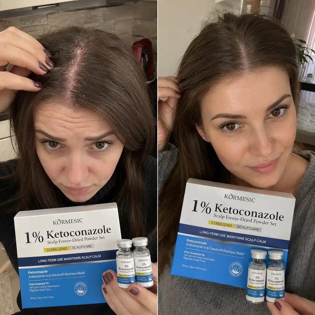 Zestaw do pielęgnacji skóry głowy z 1% ketokonazolem Kormesic – 5 × 50 mg + 5 × 3 ml