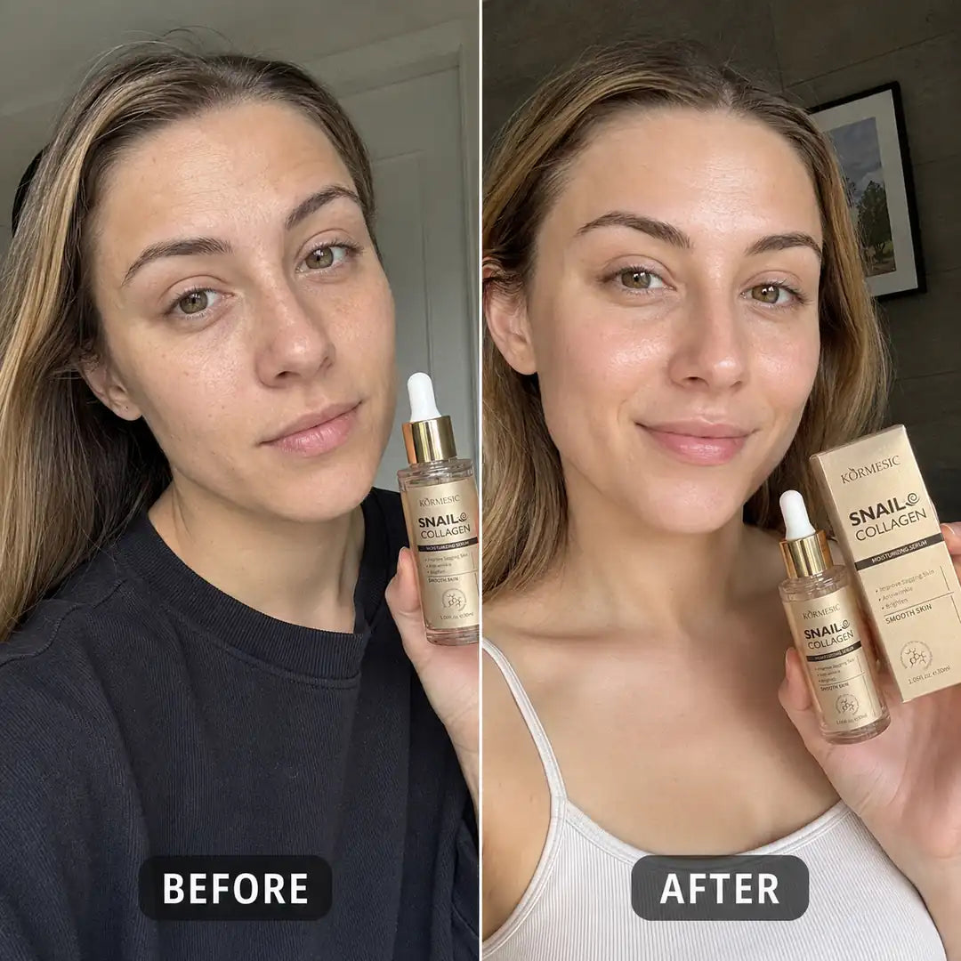 Serum do twarzy ze śluzem ślimaka i kolagenem Kormesic Snail Collagen 30 ml