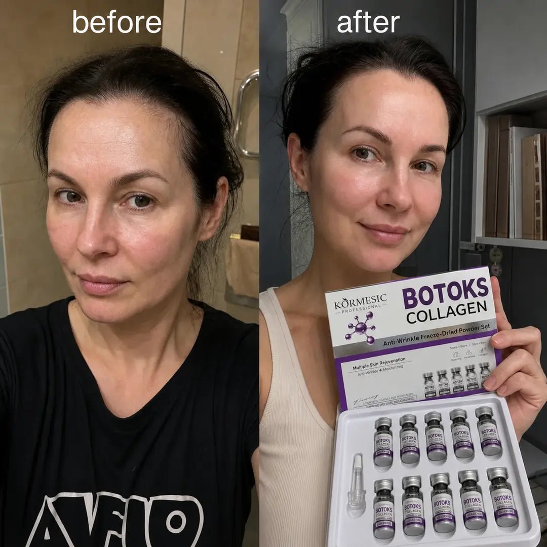 Sada ampulí proti vráskám na obličej v lyofilizované formě – Botoks Collagen 5 + 5 ks