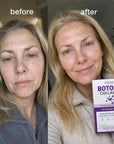 Kormesic Botoks Collagen veido serumas-ampulės nuo raukšlių – 10 × 1,5 ml