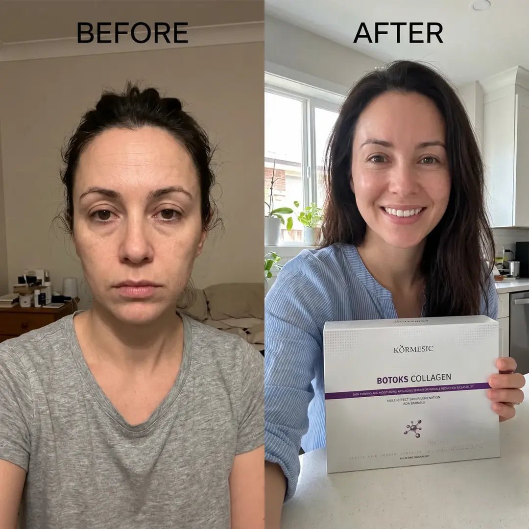 Zestaw do pielęgnacji twarzy Kormesic Botoks Collagen 5D – przeciwzmarszczkowa pielęgnacja, 5 produktów - Zestawy do twarzy