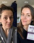 Kormesic Botoks Collagen veido serumas-ampulės nuo raukšlių – 10 × 1,5 ml