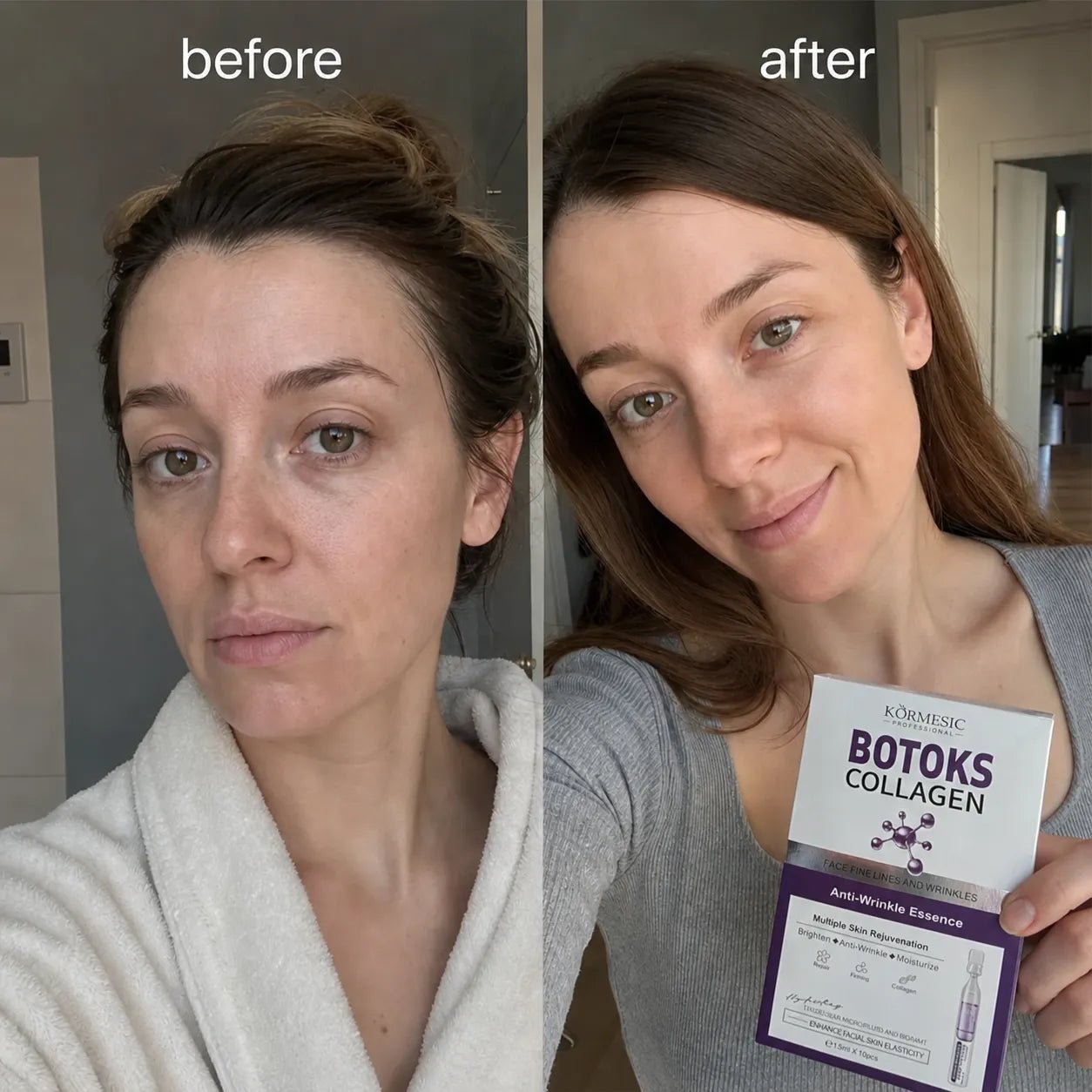 Kormesic Botoks Collagen veido serumas-ampulės nuo raukšlių – 10 × 1,5 ml