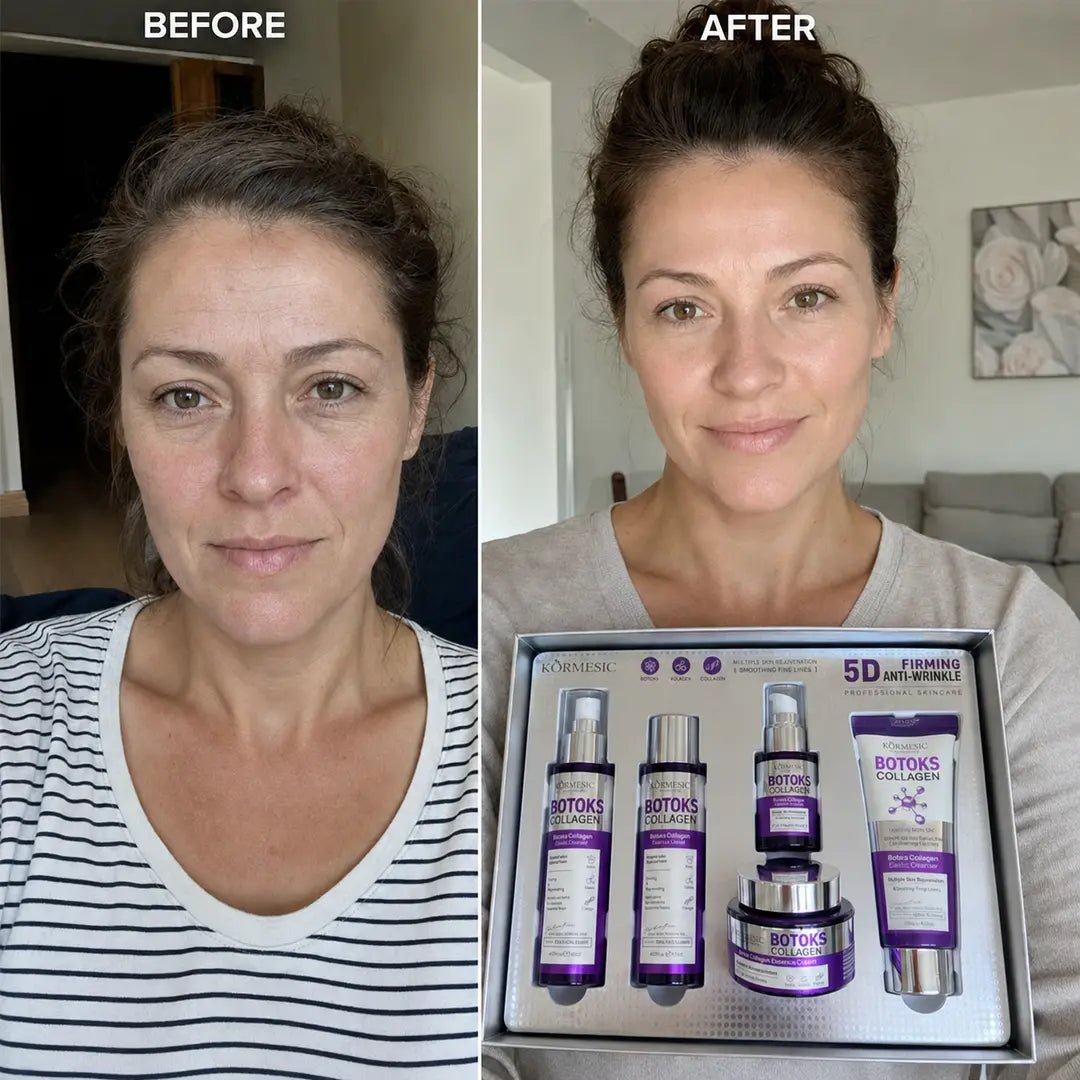 Zestaw do pielęgnacji twarzy Kormesic Botoks Collagen 5D – przeciwzmarszczkowa pielęgnacja, 5 produktów - Zestawy do twarzy