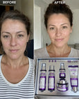 Zestaw do pielęgnacji twarzy Kormesic Botoks Collagen 5D – przeciwzmarszczkowa pielęgnacja, 5 produktów - Zestawy do twarzy