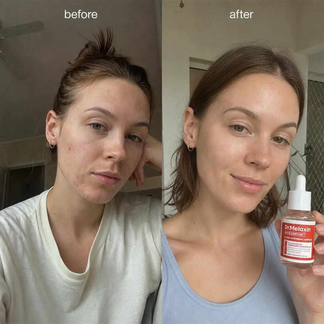Serum-Ampułka rozjaśniające do twarzy Dr.Melaxin Astaxanthin Extra Whitening – 30 ml