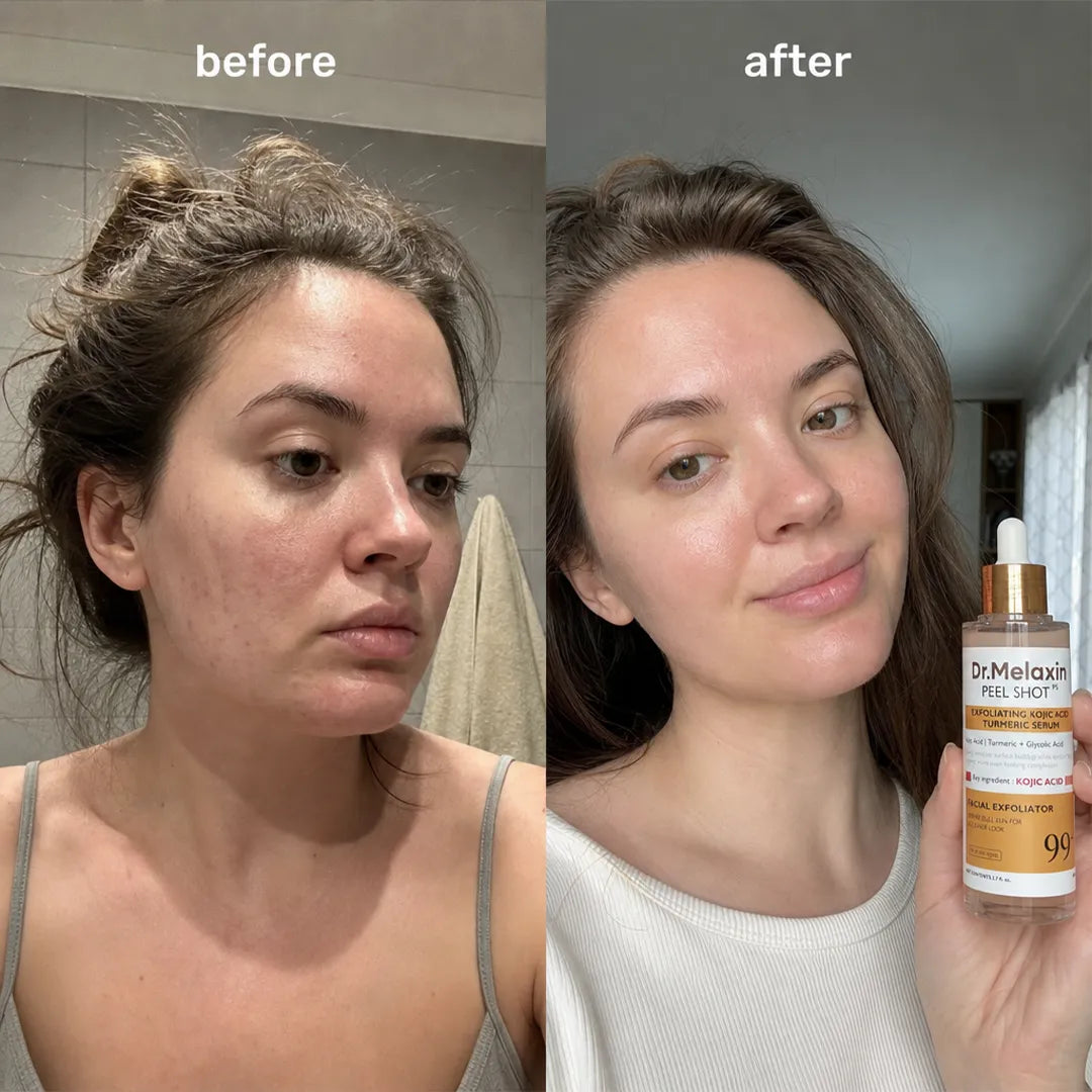 Serum złuszczające do twarzy Dr.Melaxin Peel Shot PS z kwasem kojowym i kurkumą 80 ml