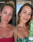 Żel po opalaniu Kormesic Aloe Vera – szybkie ukojenie, nawilżenie i regeneracja skóry po słońcu, 150 ml