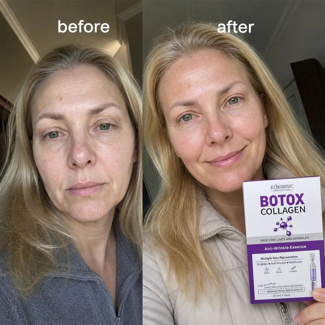 Serum-ampułki przeciwzmarszczkowe do twarzy Kormesic Botox Collagen – 10 × 1,5 ml
