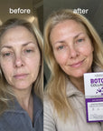 Serum-ampułki przeciwzmarszczkowe do twarzy Kormesic Botox Collagen – 10 × 1,5 ml