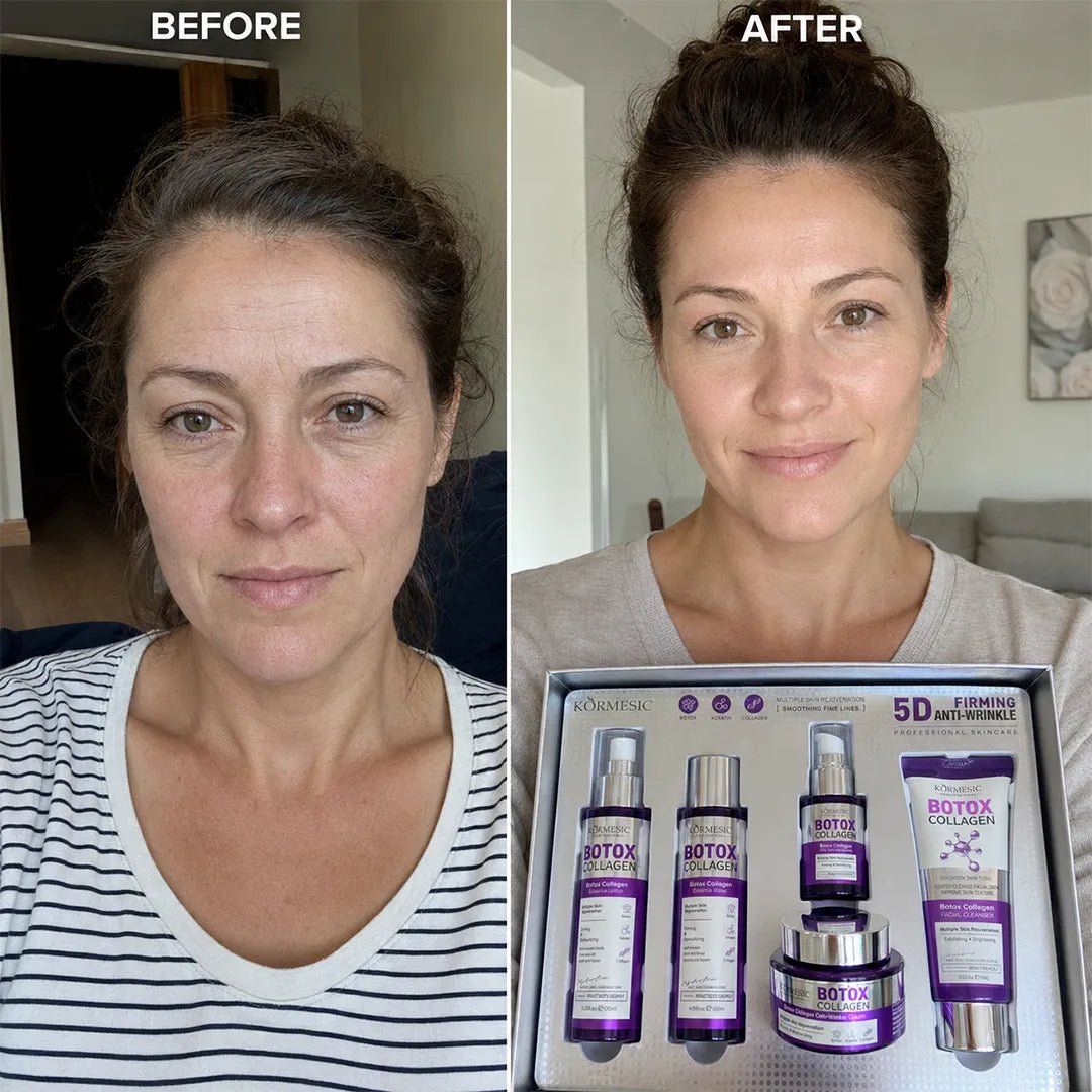 Zestaw do pielęgnacji twarzy Kormesic Botox Collagen 5D – przeciwzmarszczkowa pielęgnacja, 5 produktów