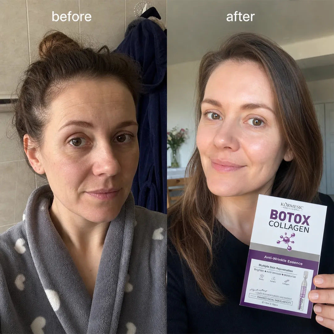 Serum-ampułki przeciwzmarszczkowe do twarzy Kormesic Botox Collagen – 10 × 1,5 ml