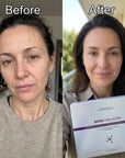 Zestaw do pielęgnacji twarzy Kormesic Botox Collagen 5D – przeciwzmarszczkowa pielęgnacja, 5 produktów