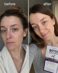 Serum-ampułki przeciwzmarszczkowe do twarzy Kormesic Botox Collagen – 10 × 1,5 ml