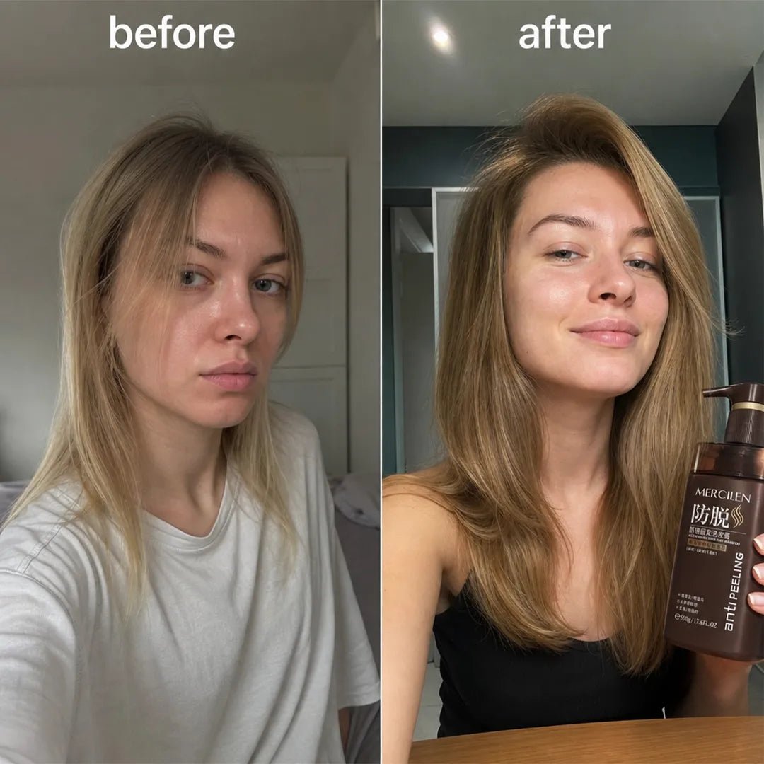 Mercilen Anti Peeling Hair Loss Shampoo – 500 g  