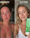 Żel po opalaniu Kormesic Aloe Vera – szybkie ukojenie, nawilżenie i regeneracja skóry po słońcu, 150 ml