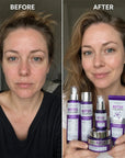 Zestaw do pielęgnacji twarzy Kormesic Botox Collagen 5D – przeciwzmarszczkowa pielęgnacja, 5 produktów