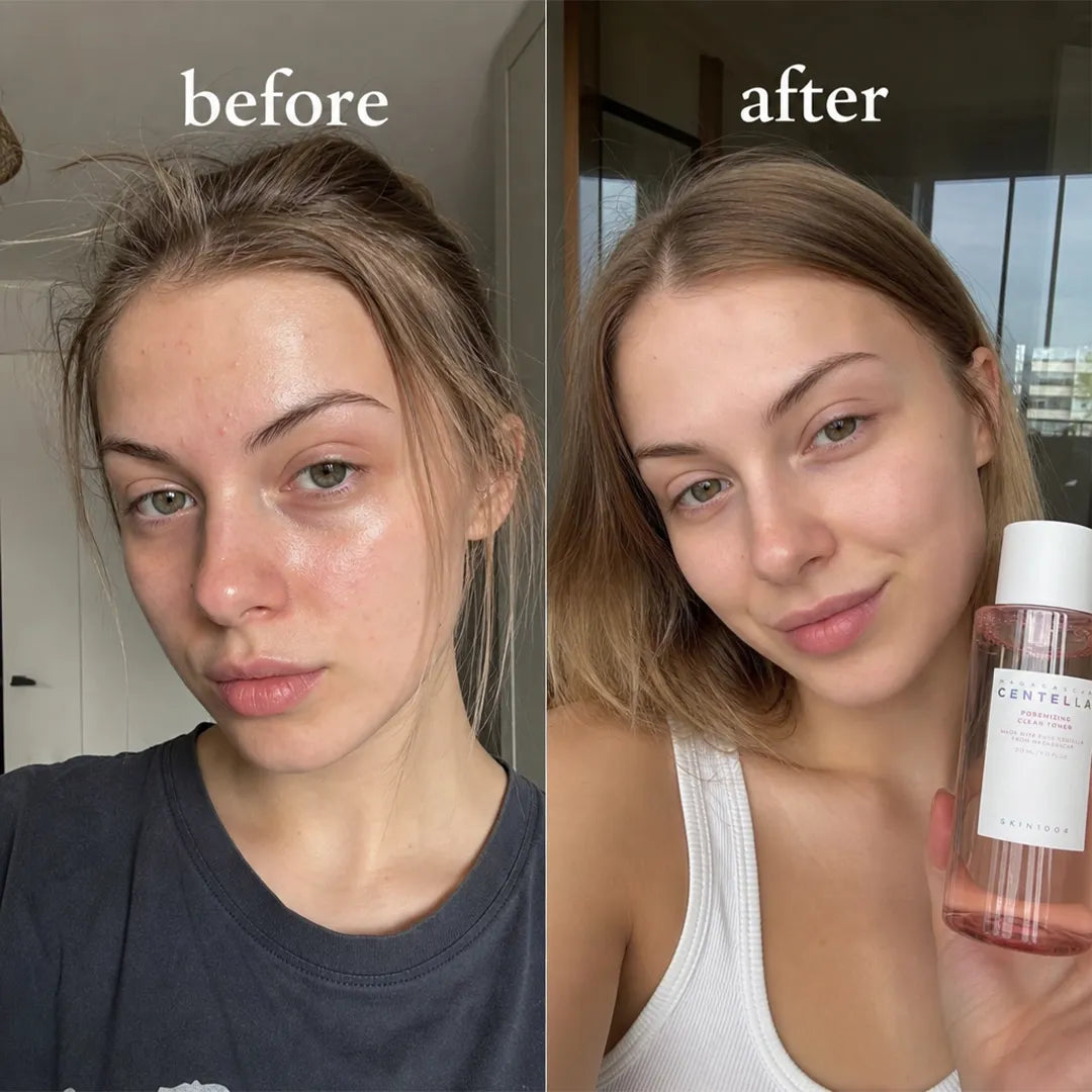 Tonik do twarzy matujący z centellą i kwasami SKIN1004 Madagascar Centella Poremizing Clear Toner – 210 ml