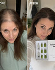 Zestaw mikroigłowy do włosów Microneedle Hair – serum zagęszczające i aplikatory, 30 ml