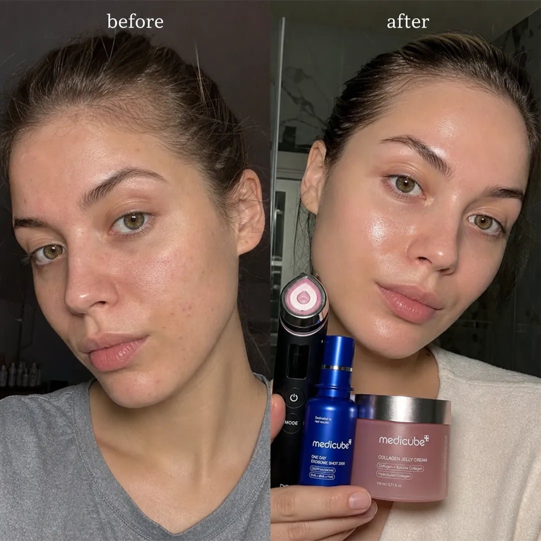 Zestaw do pielęgnacji twarzy Medicube – Triple Collagen Jelly Cream, One Day Exosome Shot Pore Ampoule 2000 i AGE-R Booster Pro