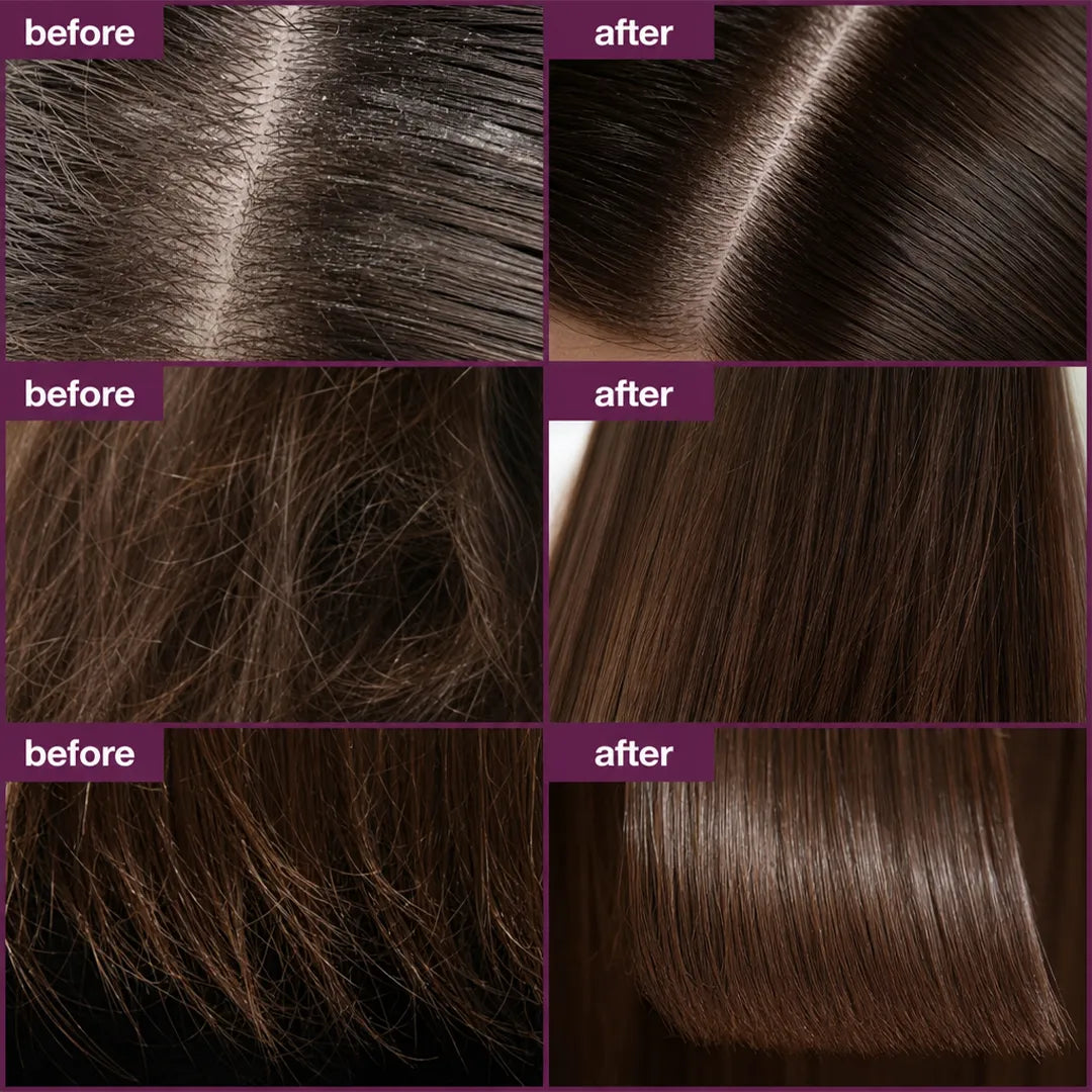 Serum roll-on do skóry głowy z keratyną i kolagenem – Kormesic Botox Keratin 10 ml