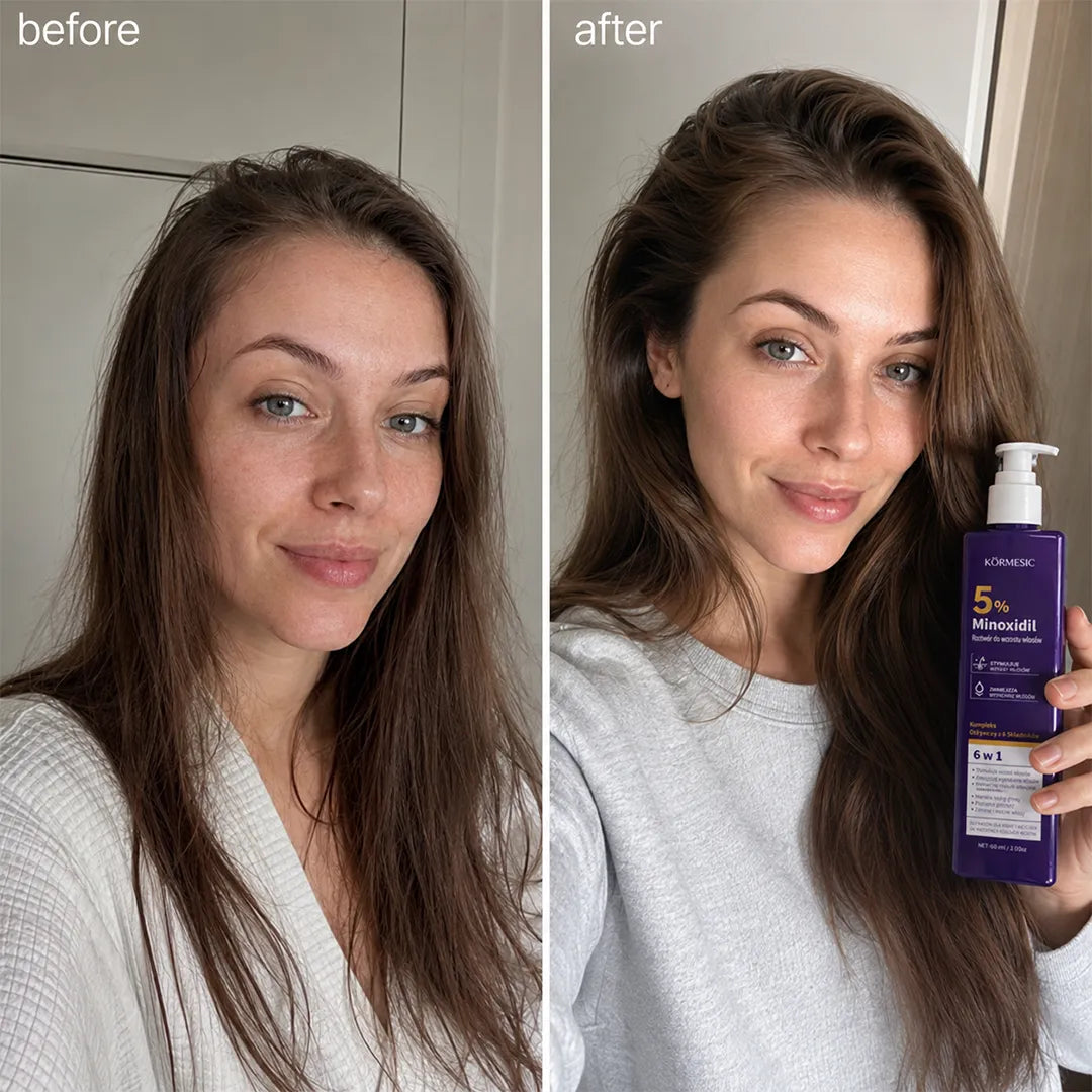 Roztwór do skóry głowy Kormesic 5% Minoxidil – wsparcie wzrostu i gęstości włosów