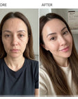 Zestaw masek do twarzy Dr.Hemerel + Maska KORMESIC GRATIS