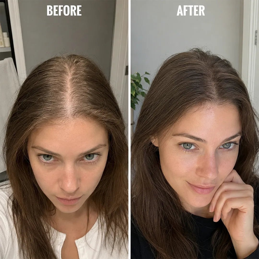 Zestaw mikroigłowy do włosów Microneedle Hair – serum zagęszczające i aplikatory, 30 ml