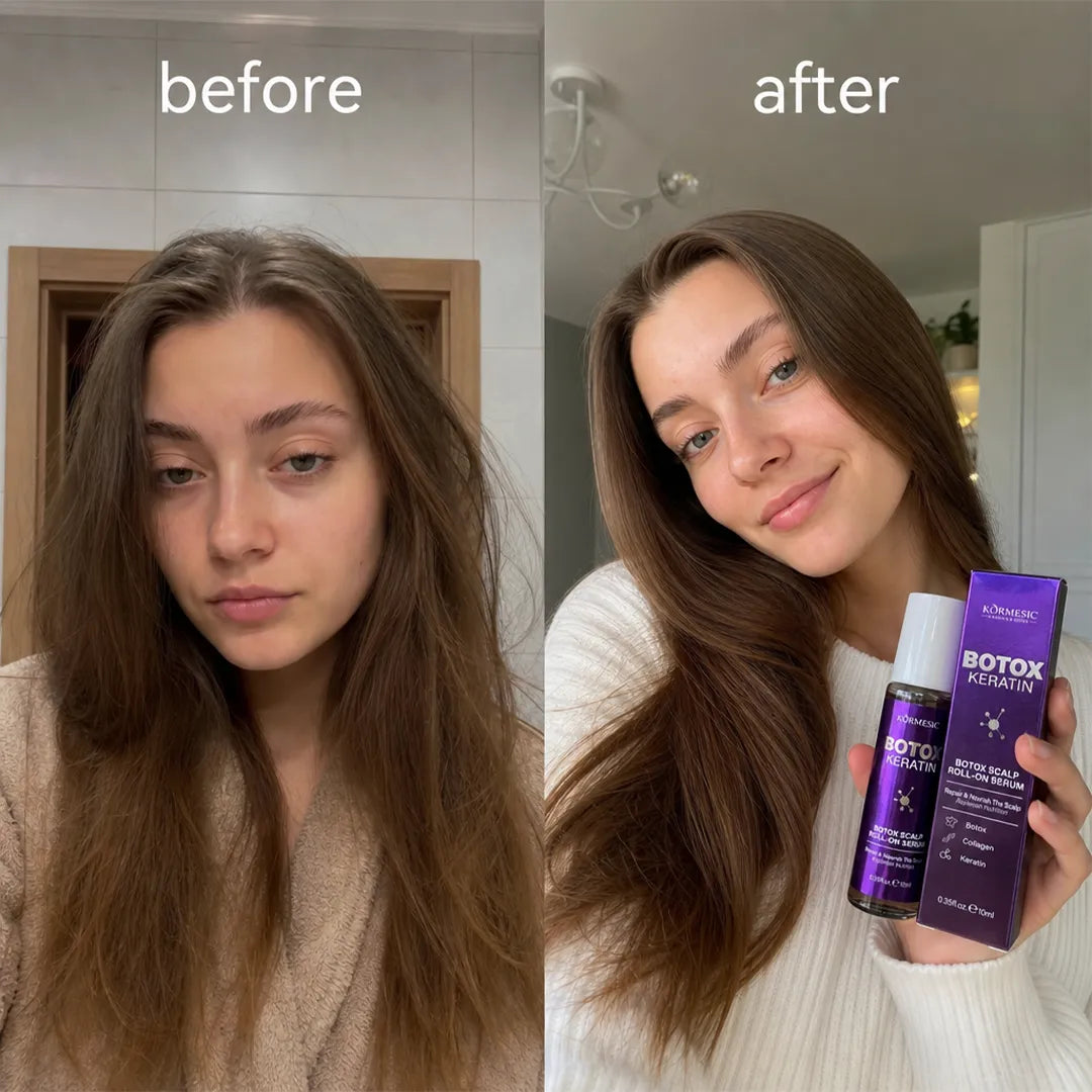 Serum roll-on do skóry głowy z keratyną i kolagenem – Kormesic Botox Keratin 10 ml