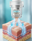 Anti-Aging-Serum mit Mikronadelbehandlung - VIARELINE