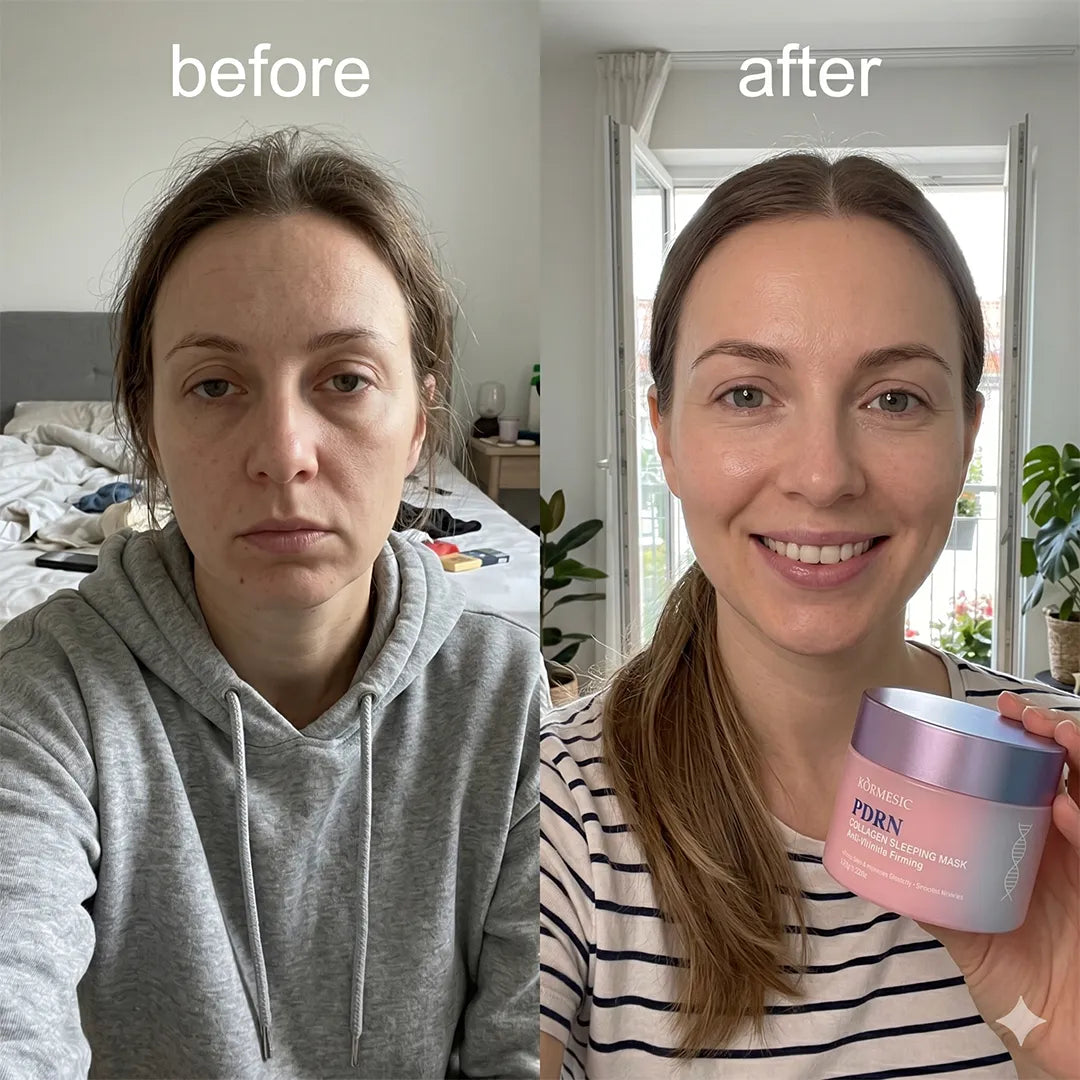 Maska do twarzy na noc Kormesic PDRN Collagen – regeneracja, ujędrnienie i wygładzenie skóry