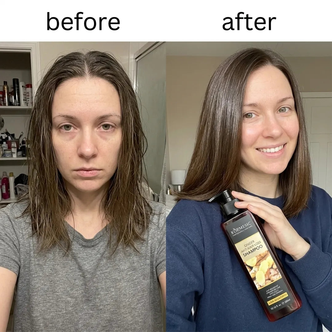 Anti-Haarausfall-Haarpflegeset mit Ingwer Kormesic – Shampoo, Spülung und Serum