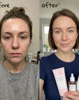 Zestaw do zwężania porów SKIN1004 Madagascar Centella Poremizing 3w1 – pianka 125 ml + ampułka 30 ml + krem-żel 75 ml