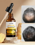 Serum do skóry głowy przeciw wypadaniu włosów z imbirem – Ginger Anti-Hair Loss, 30 ml