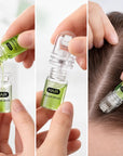 Zestaw mikroigłowy do włosów Microneedle Hair – serum zagęszczające i aplikatory, 30 ml