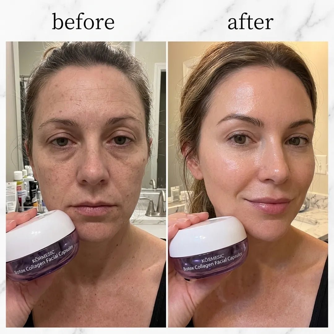 Krem kapsułkowy do twarzy Kormesic Botox Collagen – wygładzenie, nawilżenie i efekt jędrniejszej skóry