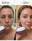 Krem kapsułkowy do twarzy Kormesic Botox Collagen – wygładzenie, nawilżenie i efekt jędrniejszej skóry