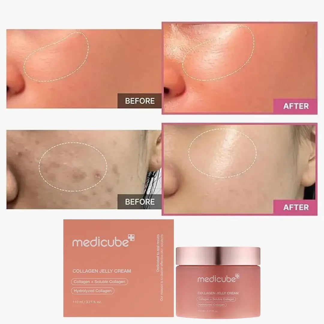 Kolagenowy krem żelowy – intensywne nawilżenie i ujędrnienie skóry