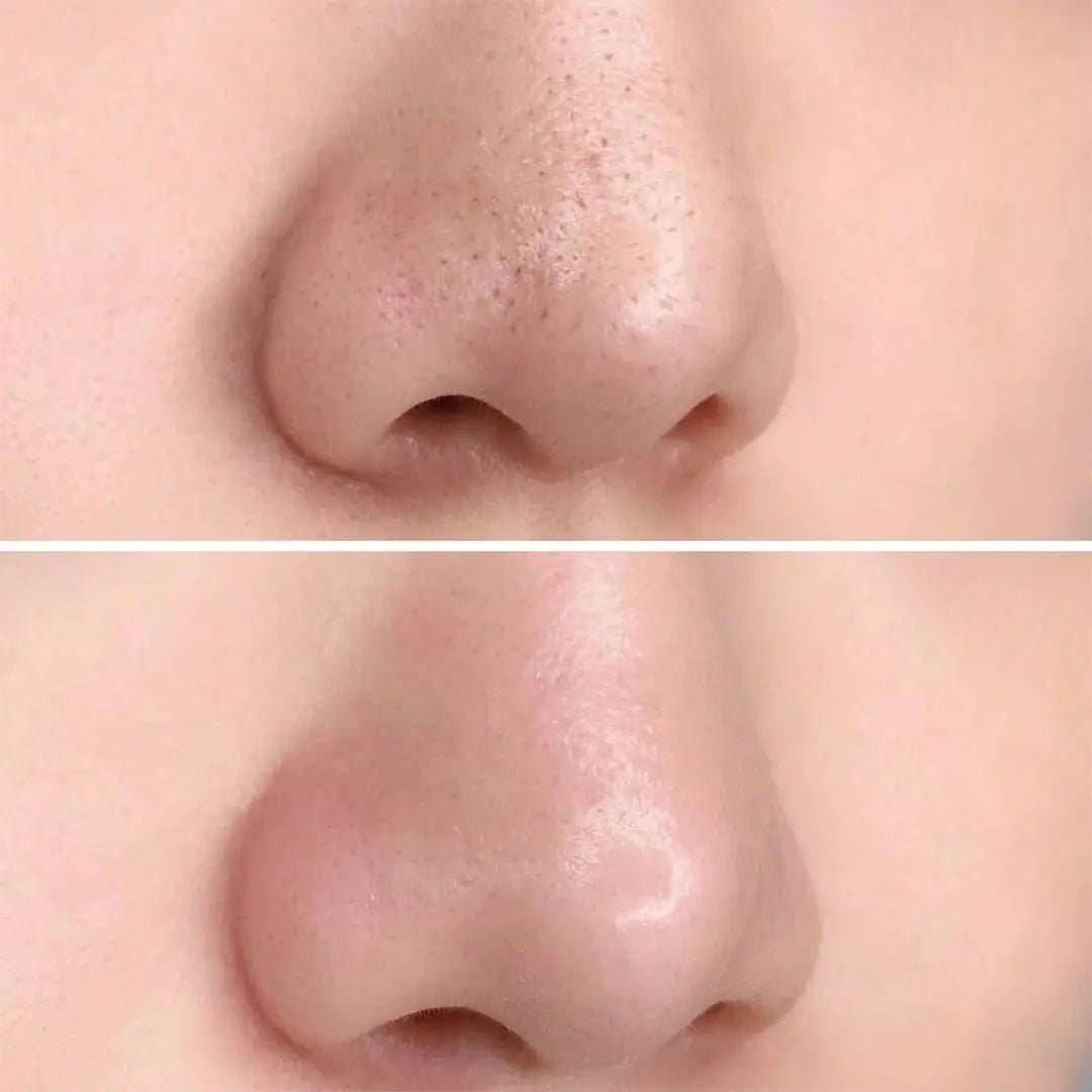 SKIN1004 Poremizing Maseczka w sztyfcie 27g