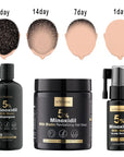 Zestaw przeciw wypadaniu włosów z minoksydylem 5% Kormesic (szampon + maska + serum)
