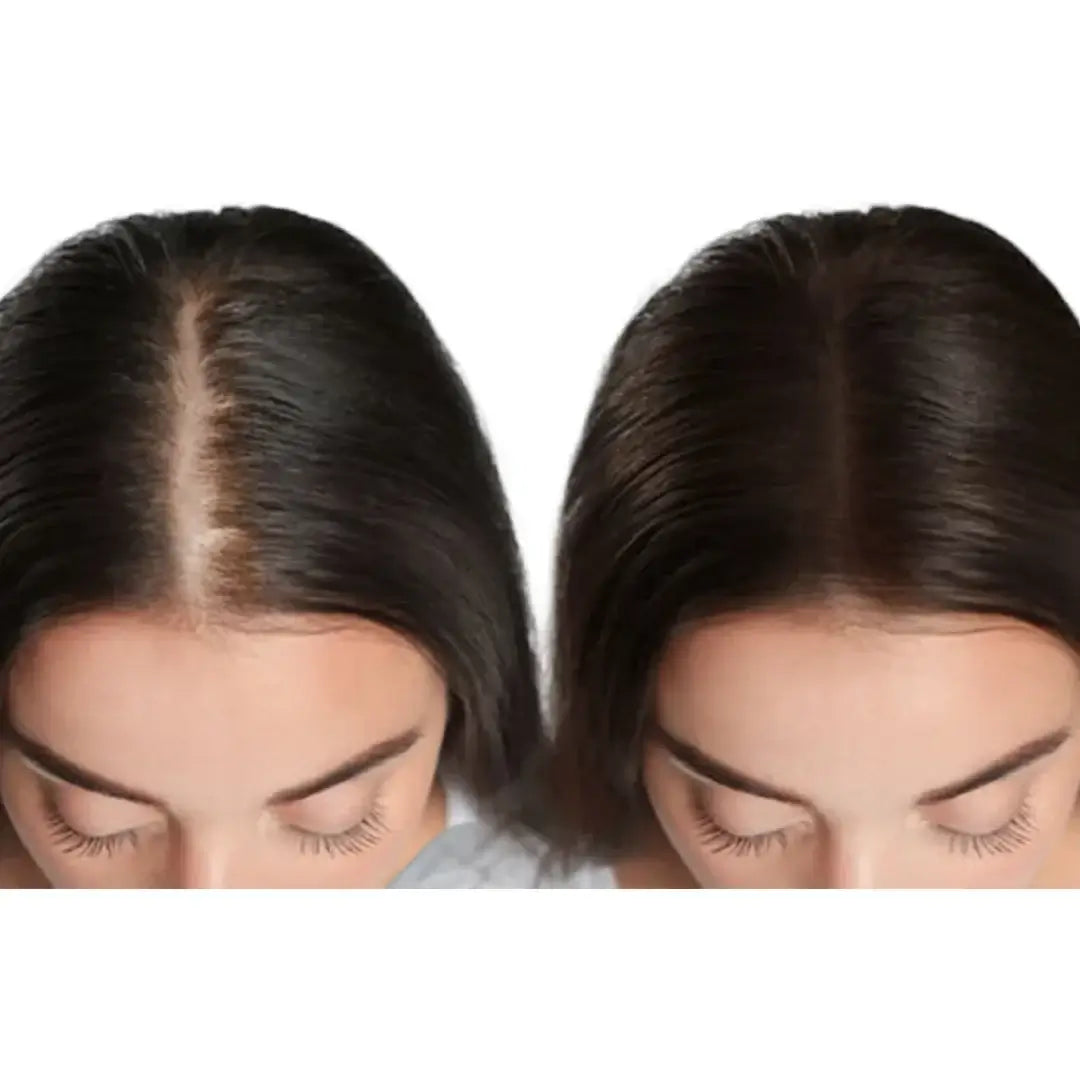 Zestaw przeciw wypadaniu włosów z minoksydylem 5% Kormesic (szampon + maska + serum)