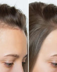 Zestaw przeciw wypadaniu włosów z minoksydylem 5% Kormesic (szampon + maska + serum)