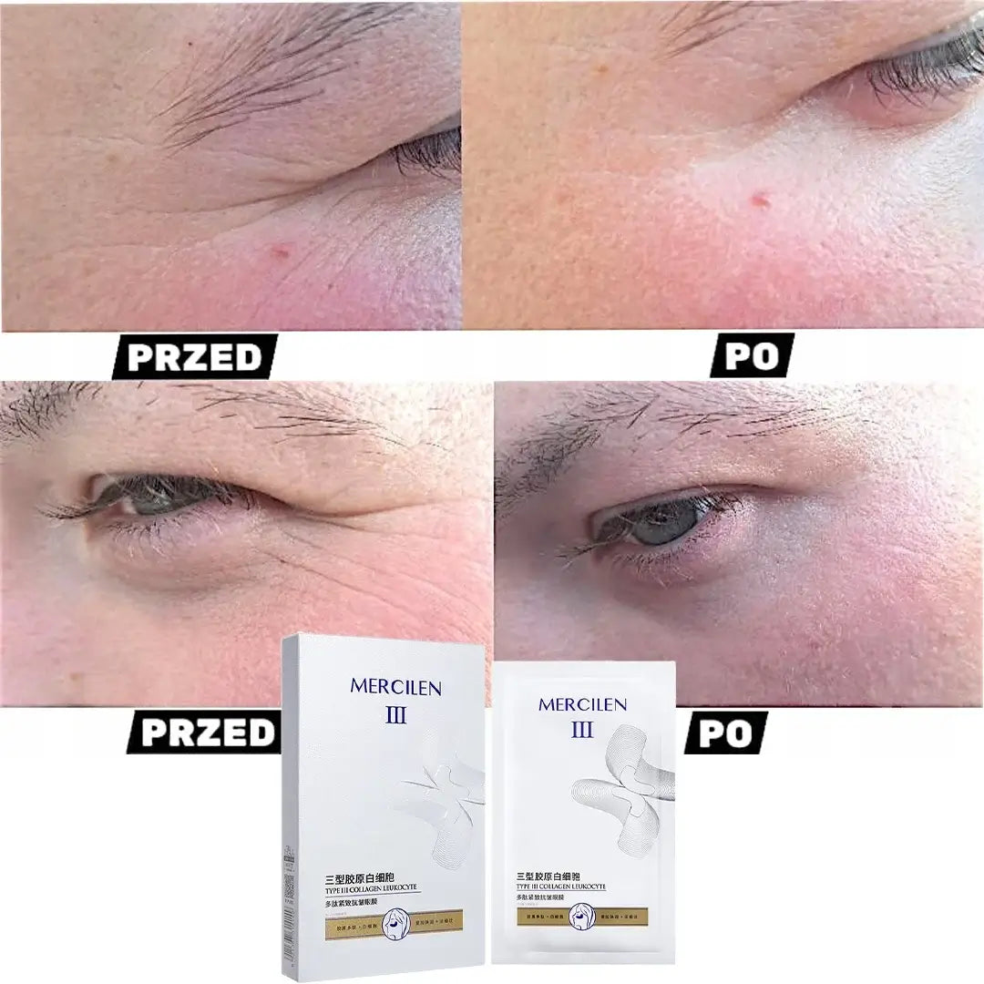 MERCILEN kolagenové oční náplasti pro rychlou hydrataci a vyhlazení