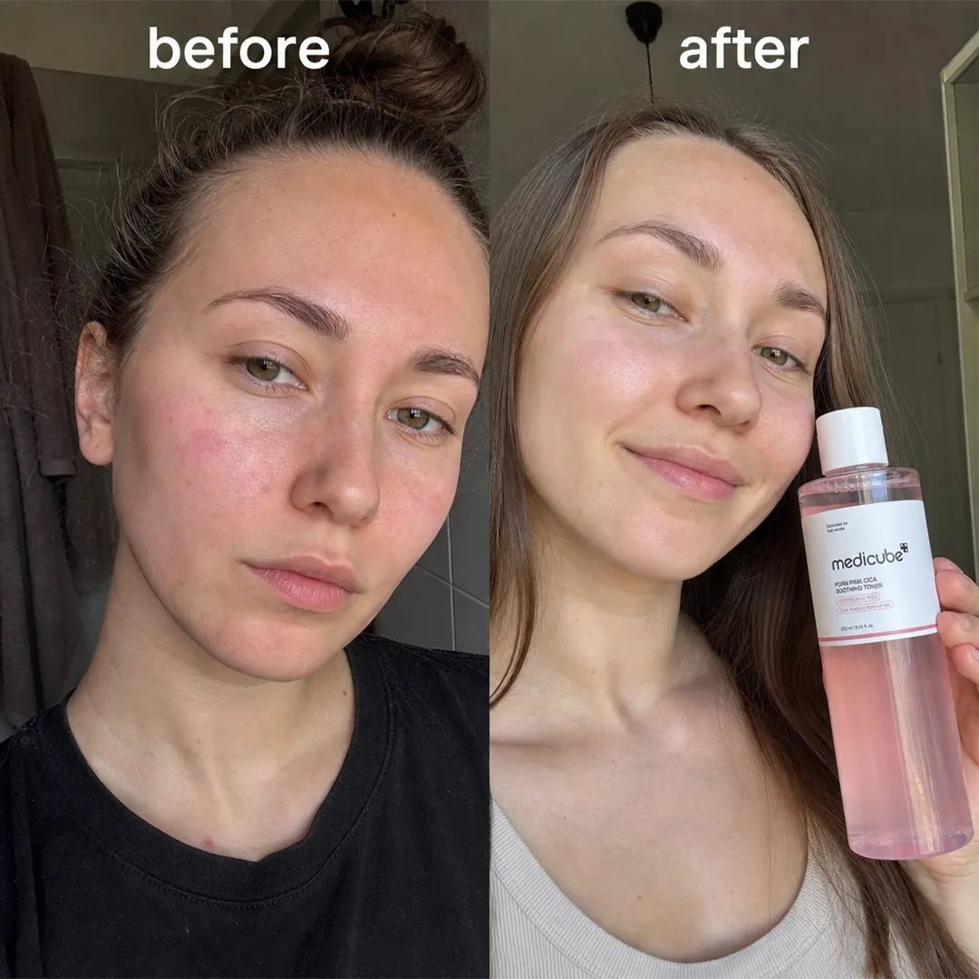 Tonik do twarzy z PDRN i wąkrotą azjatycką Medicube PDRN Pink Cica Soothing Toner – 250 ml