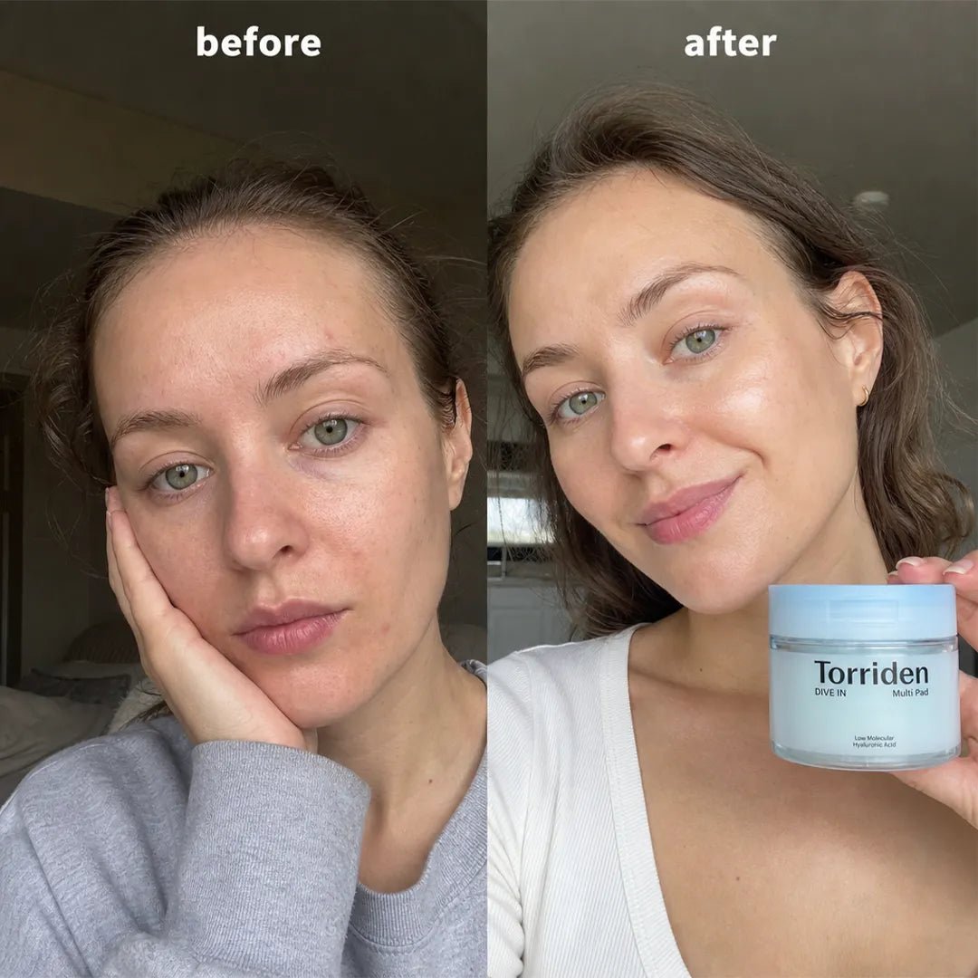 Płatki do twarzy nawilżające Torriden Dive-In Low Molecule Hyaluronic Acid Multi Pad – 80 szt.