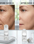 Anti-Aging-Serum mit Mikronadelbehandlung - VIARELINE