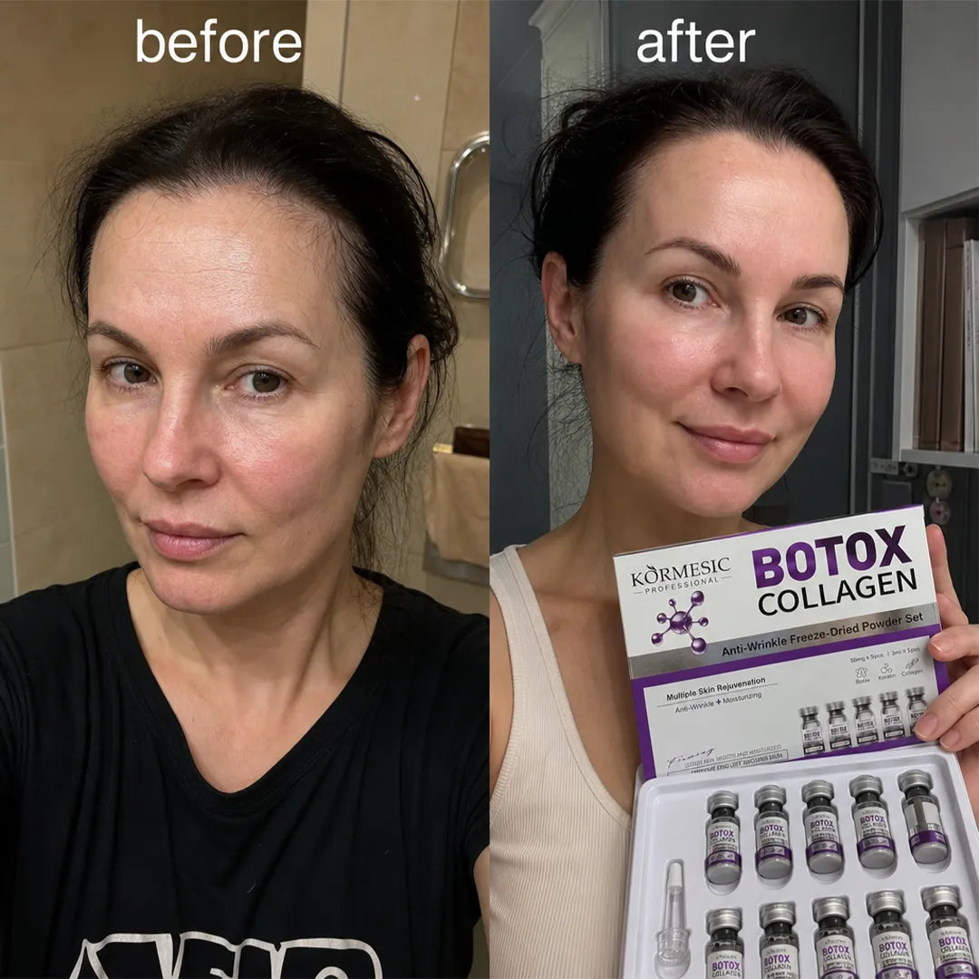 Zestaw przeciwzmarszczkowy do twarzy w ampułkach liofilizowanych – Botox Collagen 5 + 5 szt.