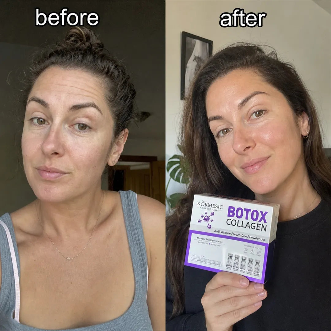 Zestaw przeciwzmarszczkowy do twarzy w ampułkach liofilizowanych – Botox Collagen 5 + 5 szt.