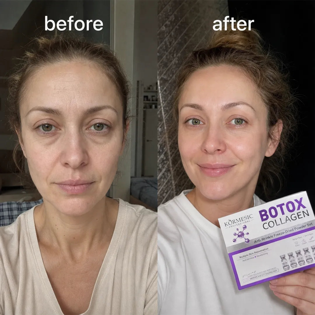 Zestaw przeciwzmarszczkowy do twarzy w ampułkach liofilizowanych – Botox Collagen 5 + 5 szt.