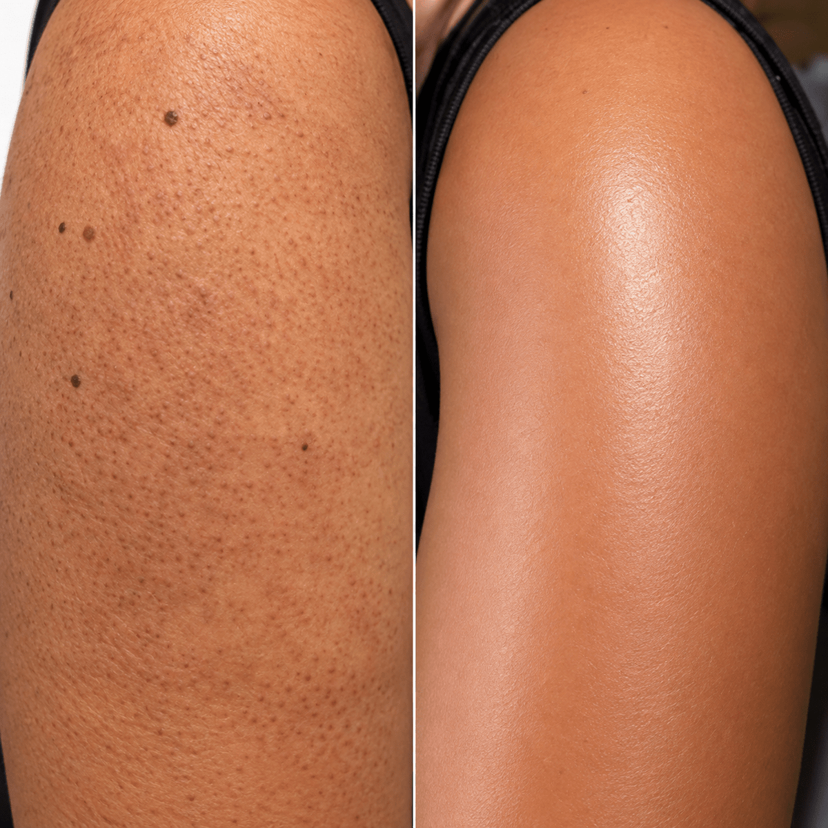 Medicube Body Peel Shot – serum złuszczające do ciała z kwasem podchlorawym, 280 ml - Peelingi do ciała